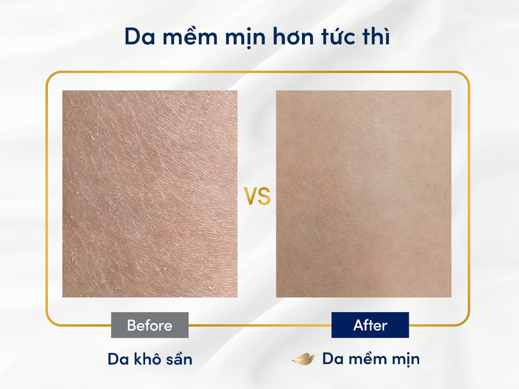 Sua Tam Duong The Dove Duong Am Chuyen Sau 500g 202303061346374396